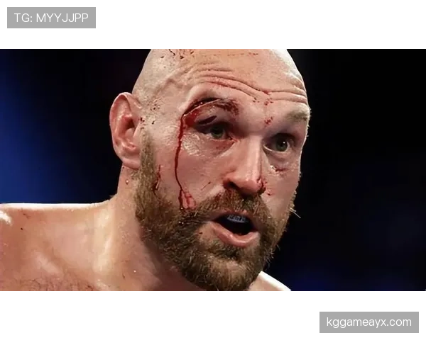 泰森·富里赛后直接躺草地上啃汉堡，这自律人设是不是有点绷不住了？